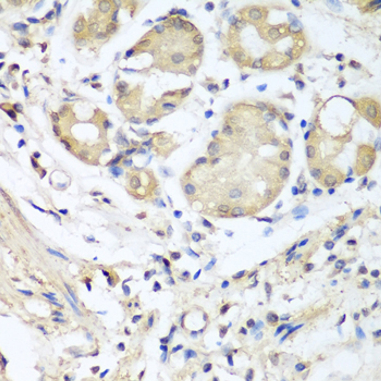 Immunohistochemistry of paraffin-embedded human stomach using NID1 antibody (23-523) at dilution of 1:100 (40x lens) .