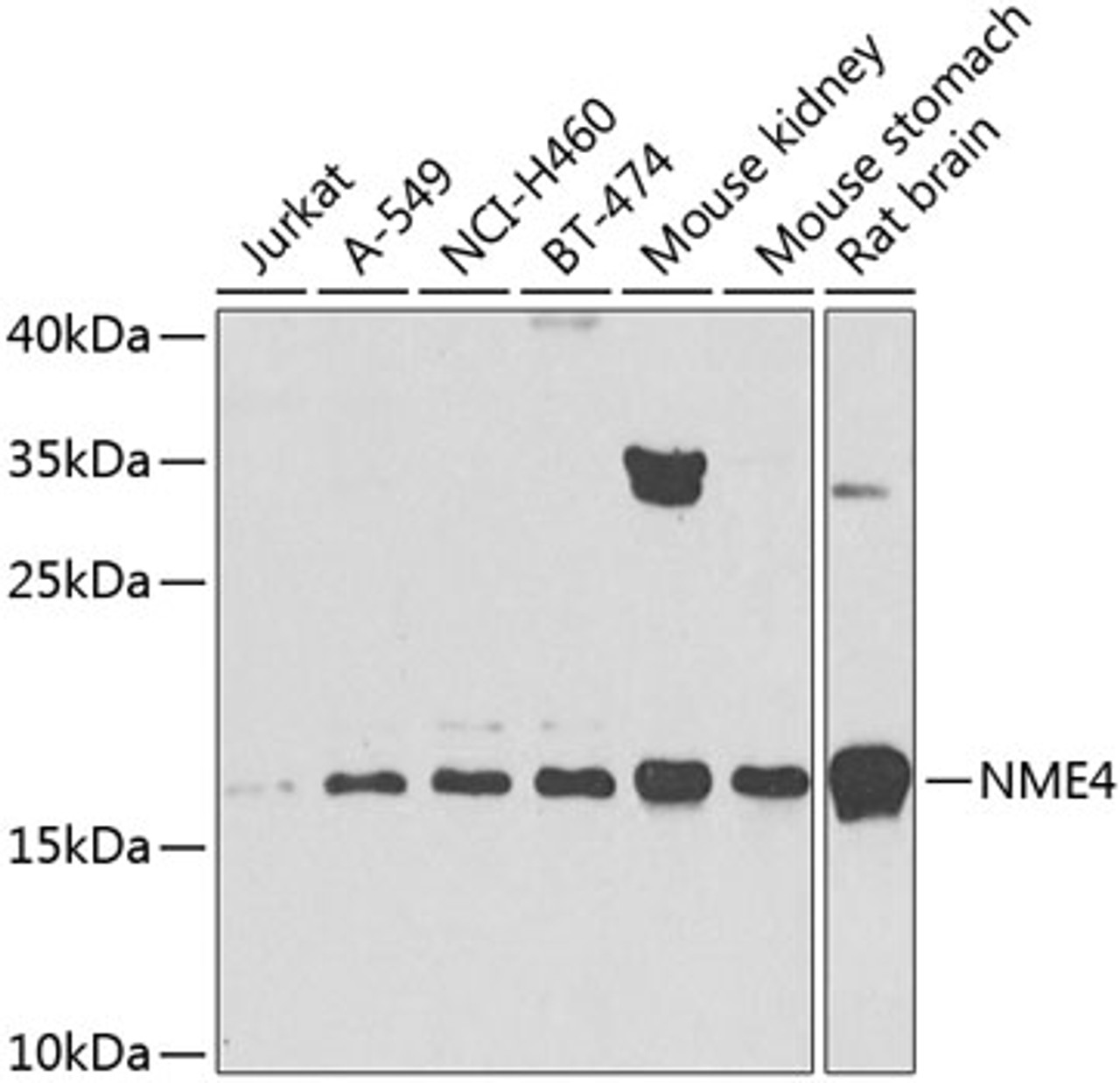 Western blot analysis of extracts of various cell lines, using NME4 antibody (23-524) at 1:1000 dilution.<br/>Secondary antibody: HRP Goat Anti-Rabbit IgG (H+L) at 1:10000 dilution.<br/>Lysates/proteins: 25ug per lane.<br/>Blocking buffer: 3% nonfat dry milk in TBST.<br/>Detection: ECL Basic Kit.<br/>Exposure time: 60s.