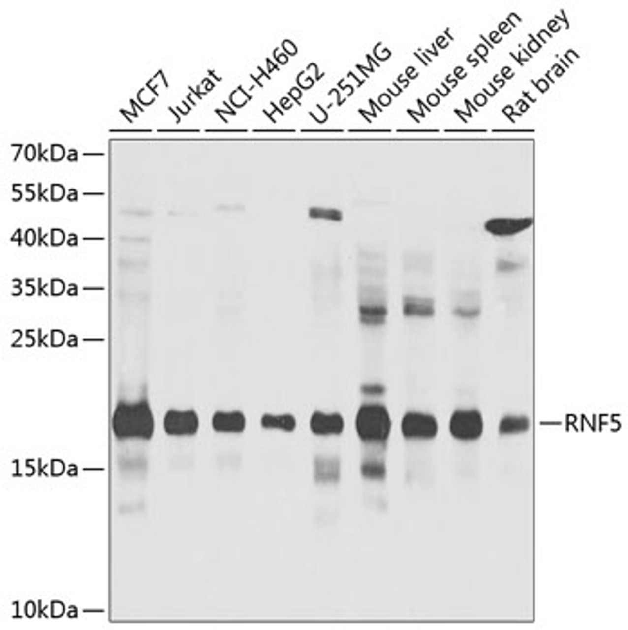 Western blot analysis of extracts of various cell lines, using RNF5 antibody (23-525) at 1:1000 dilution.<br/>Secondary antibody: HRP Goat Anti-Rabbit IgG (H+L) at 1:10000 dilution.<br/>Lysates/proteins: 25ug per lane.<br/>Blocking buffer: 3% nonfat dry milk in TBST.<br/>Detection: ECL Basic Kit.<br/>Exposure time: 30s.
