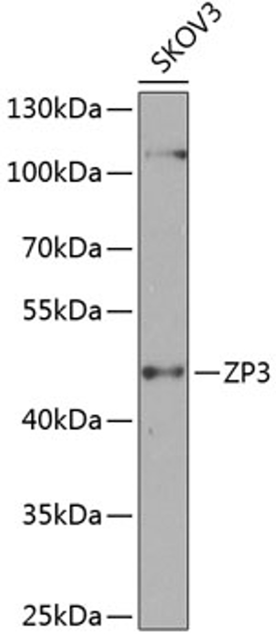 Western blot analysis of extracts of SKOV3 cells, using ZP3 antibody (23-528) at 1:1000 dilution.<br/>Secondary antibody: HRP Goat Anti-Rabbit IgG (H+L) at 1:10000 dilution.<br/>Lysates/proteins: 25ug per lane.<br/>Blocking buffer: 3% nonfat dry milk in TBST.<br/>Detection: ECL Basic Kit.<br/>Exposure time: 90s.