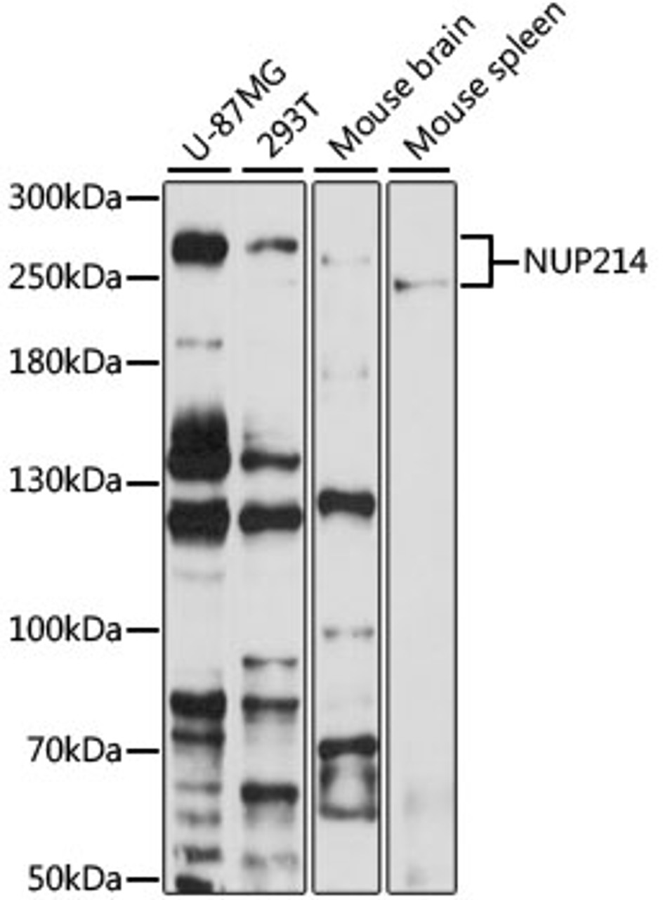 Western blot analysis of extracts of various cell lines, using NUP214 antibody (23-530) at 1:1000 dilution.<br/>Secondary antibody: HRP Goat Anti-Rabbit IgG (H+L) at 1:10000 dilution.<br/>Lysates/proteins: 25ug per lane.<br/>Blocking buffer: 3% nonfat dry milk in TBST.<br/>Detection: ECL Basic Kit.<br/>Exposure time: 60s.