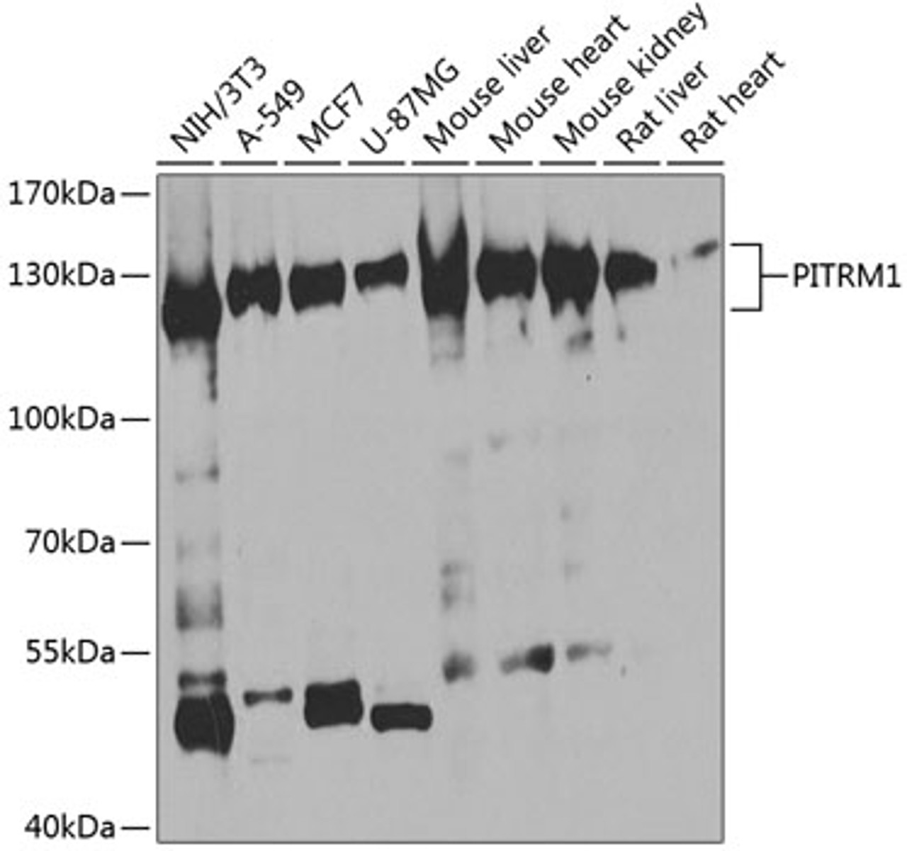 Western blot analysis of extracts of various cell lines, using PITRM1 antibody (23-535) at 1:1000 dilution.<br/>Secondary antibody: HRP Goat Anti-Rabbit IgG (H+L) at 1:10000 dilution.<br/>Lysates/proteins: 25ug per lane.<br/>Blocking buffer: 3% nonfat dry milk in TBST.<br/>Detection: ECL Basic Kit.<br/>Exposure time: 30s.