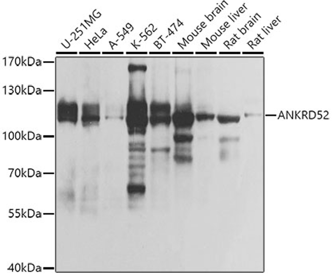 Western blot analysis of extracts of various cell lines, using ANKRD52 antibody (23-543) at 1:1000 dilution.<br/>Secondary antibody: HRP Goat Anti-Rabbit IgG (H+L) at 1:10000 dilution.<br/>Lysates/proteins: 25ug per lane.<br/>Blocking buffer: 3% nonfat dry milk in TBST.<br/>Detection: ECL Basic Kit.<br/>Exposure time: 1s.