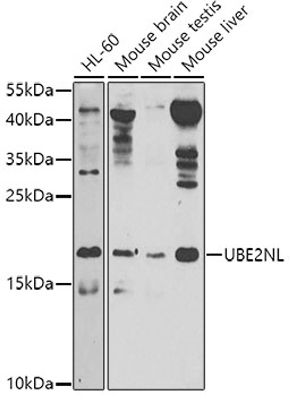 Western blot analysis of extracts of various cell lines, using UBE2NL antibody (23-545) at 1:1000 dilution.<br/>Secondary antibody: HRP Goat Anti-Rabbit IgG (H+L) at 1:10000 dilution.<br/>Lysates/proteins: 25ug per lane.<br/>Blocking buffer: 3% nonfat dry milk in TBST.<br/>Detection: ECL Basic Kit.<br/>Exposure time: 60s.