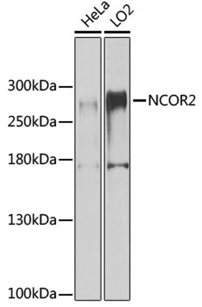 Western blot analysis of extracts of various cell lines, using NCOR2 antibody (23-548) at 1:1000 dilution.<br/>Secondary antibody: HRP Goat Anti-Rabbit IgG (H+L) at 1:10000 dilution.<br/>Lysates/proteins: 25ug per lane.<br/>Blocking buffer: 3% nonfat dry milk in TBST.<br/>Detection: ECL Basic Kit.