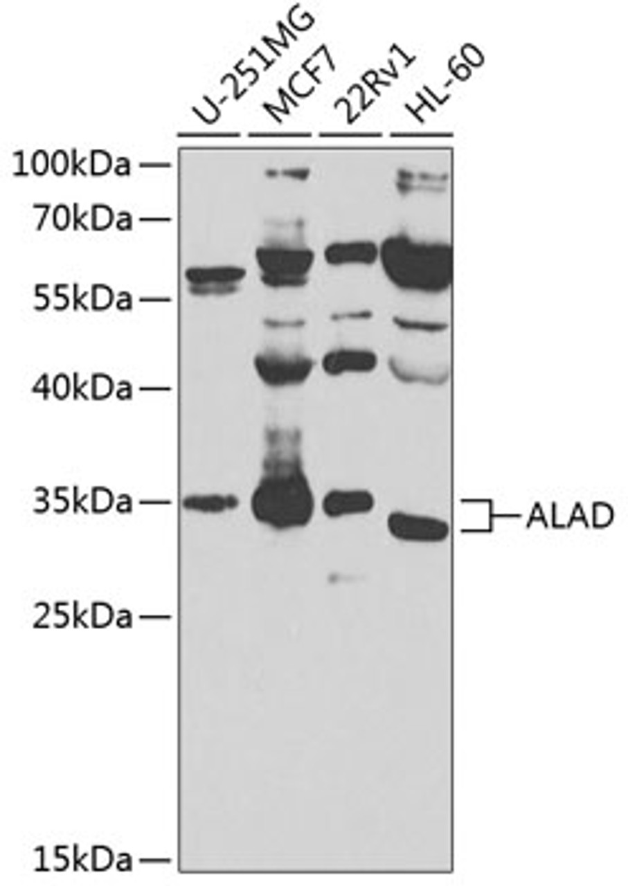 Western blot analysis of extracts of various cell lines, using ALAD antibody (23-555) at 1:1000 dilution.<br/>Secondary antibody: HRP Goat Anti-Rabbit IgG (H+L) at 1:10000 dilution.<br/>Lysates/proteins: 25ug per lane.<br/>Blocking buffer: 3% nonfat dry milk in TBST.<br/>Detection: ECL Basic Kit.<br/>Exposure time: 90s.