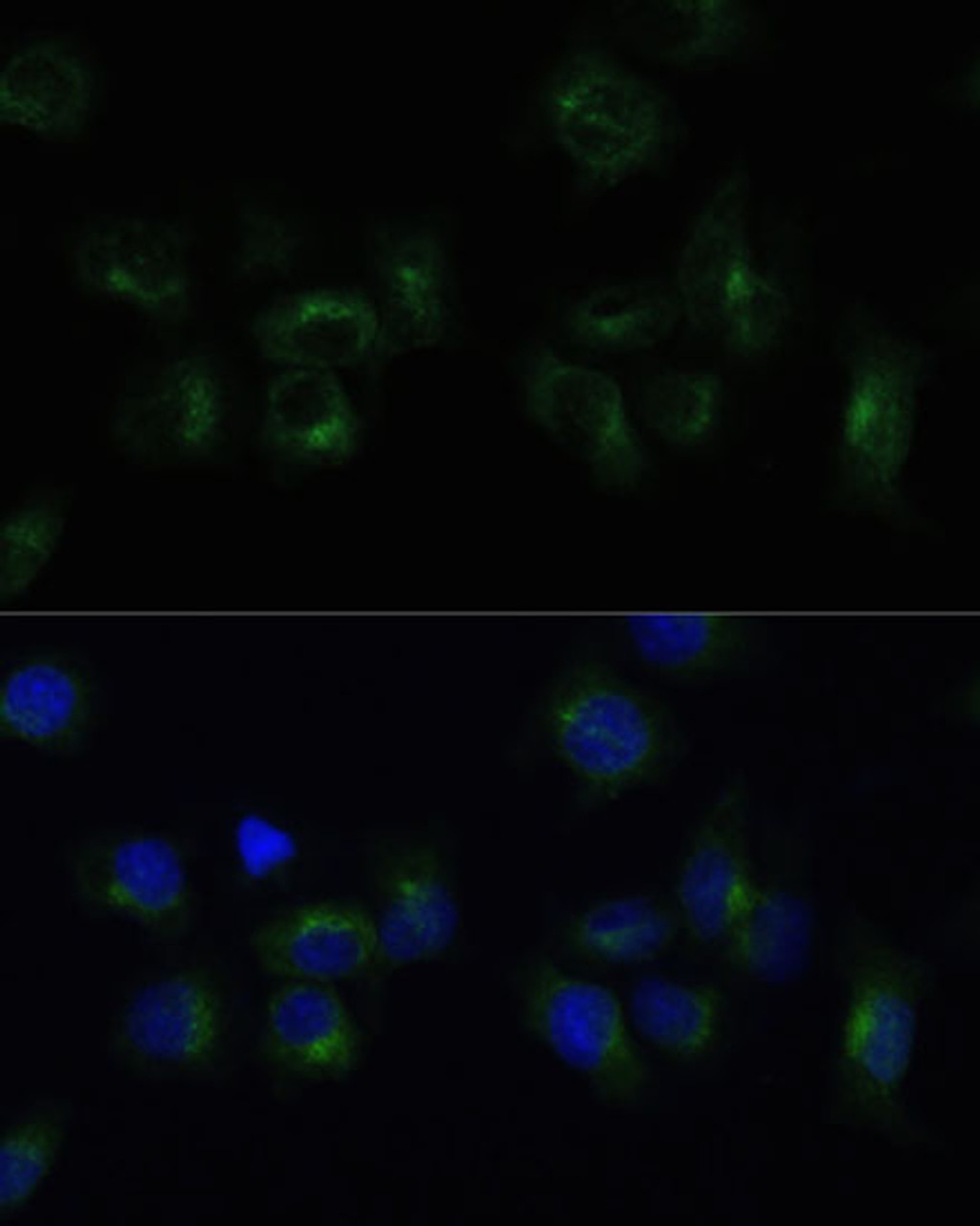 Immunofluorescence analysis of HeLa cells using CLTB Polyclonal Antibody (23-560) at dilution of 1:100 (40x lens) . Blue: DAPI for nuclear staining.