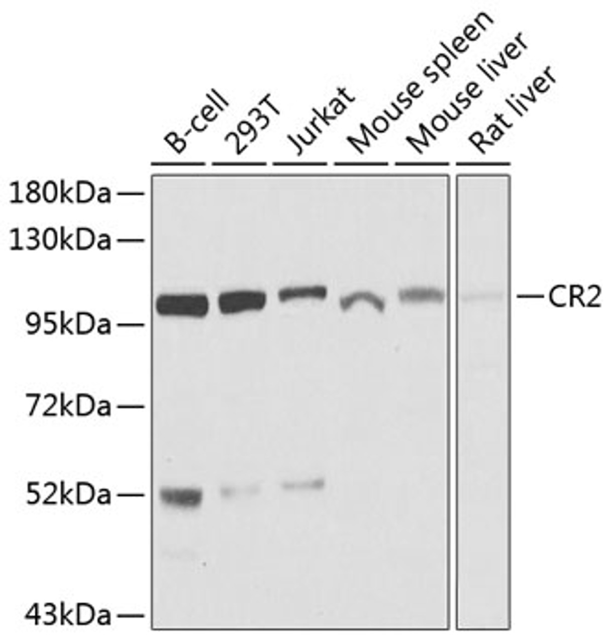 Western blot analysis of extracts of various cell lines, using CR2 antibody (23-562) at 1:1000 dilution.<br/>Secondary antibody: HRP Goat Anti-Rabbit IgG (H+L) at 1:10000 dilution.<br/>Lysates/proteins: 25ug per lane.<br/>Blocking buffer: 3% nonfat dry milk in TBST.<br/>Detection: ECL Basic Kit.<br/>Exposure time: 15s.