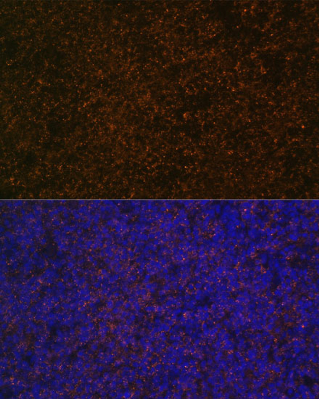 Immunofluorescence analysis of rat spleen using CR2 Polyclonal Antibody (23-562) at dilution of 1:100 (40x lens) . Blue: DAPI for nuclear staining.