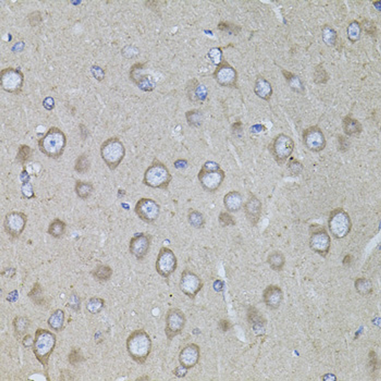 Immunohistochemistry of paraffin-embedded rat brain using CRHR1 antibody (23-564) at dilution of 1:100 (40x lens) .