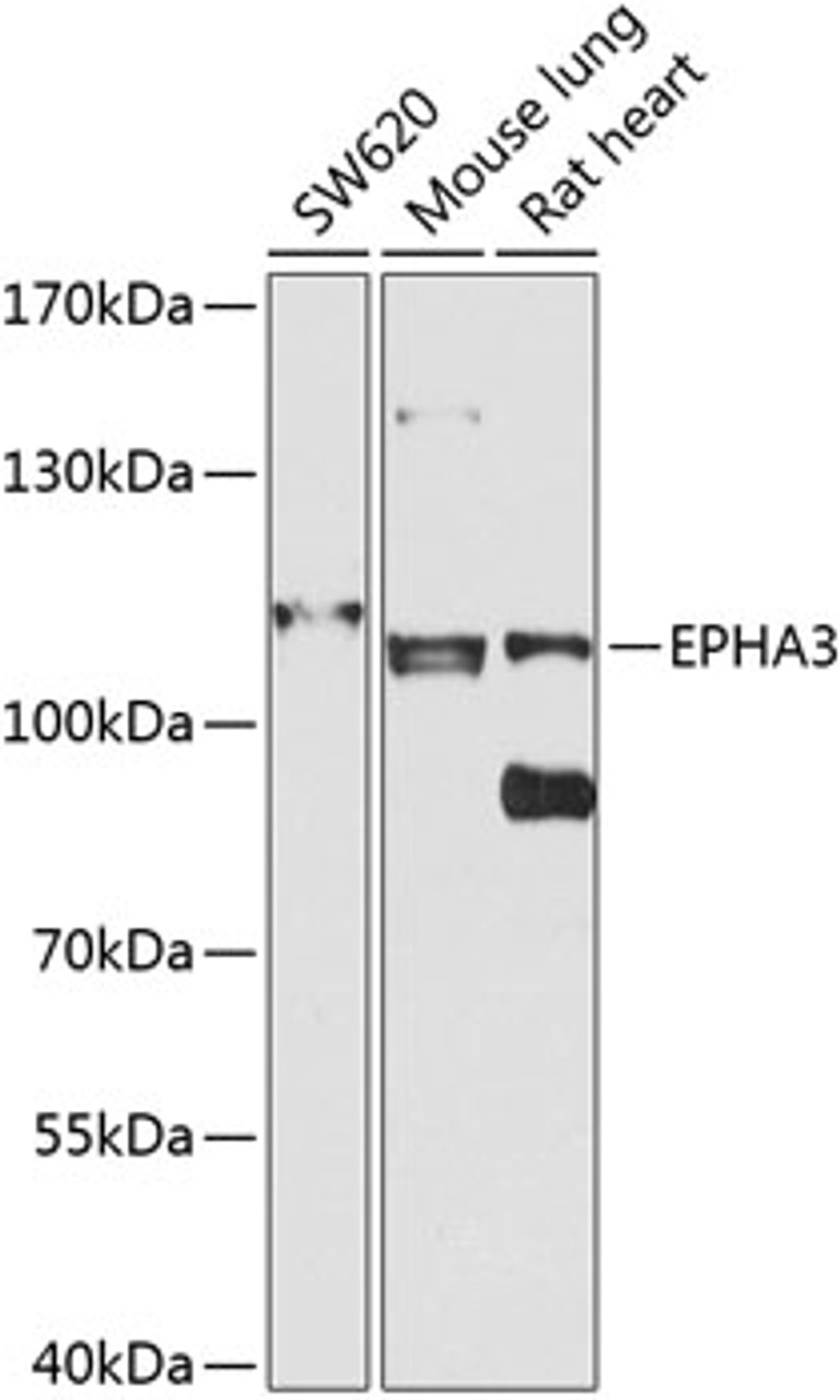 Western blot analysis of extracts of various cell lines, using EPHA3 antibody (23-567) at 1:1000 dilution.<br/>Secondary antibody: HRP Goat Anti-Rabbit IgG (H+L) at 1:10000 dilution.<br/>Lysates/proteins: 25ug per lane.<br/>Blocking buffer: 3% nonfat dry milk in TBST.<br/>Detection: ECL Basic Kit.<br/>Exposure time: 30s.
