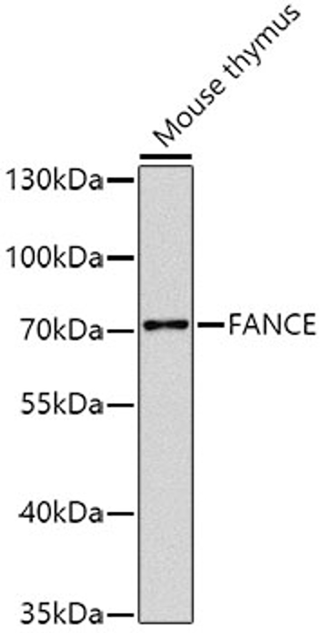 Western blot analysis of extracts of mouse thymus, using FANCE antibody (23-568) at 1:1000 dilution.<br/>Secondary antibody: HRP Goat Anti-Rabbit IgG (H+L) at 1:10000 dilution.<br/>Lysates/proteins: 25ug per lane.<br/>Blocking buffer: 3% nonfat dry milk in TBST.<br/>Detection: ECL Basic Kit.<br/>Exposure time: 10s.