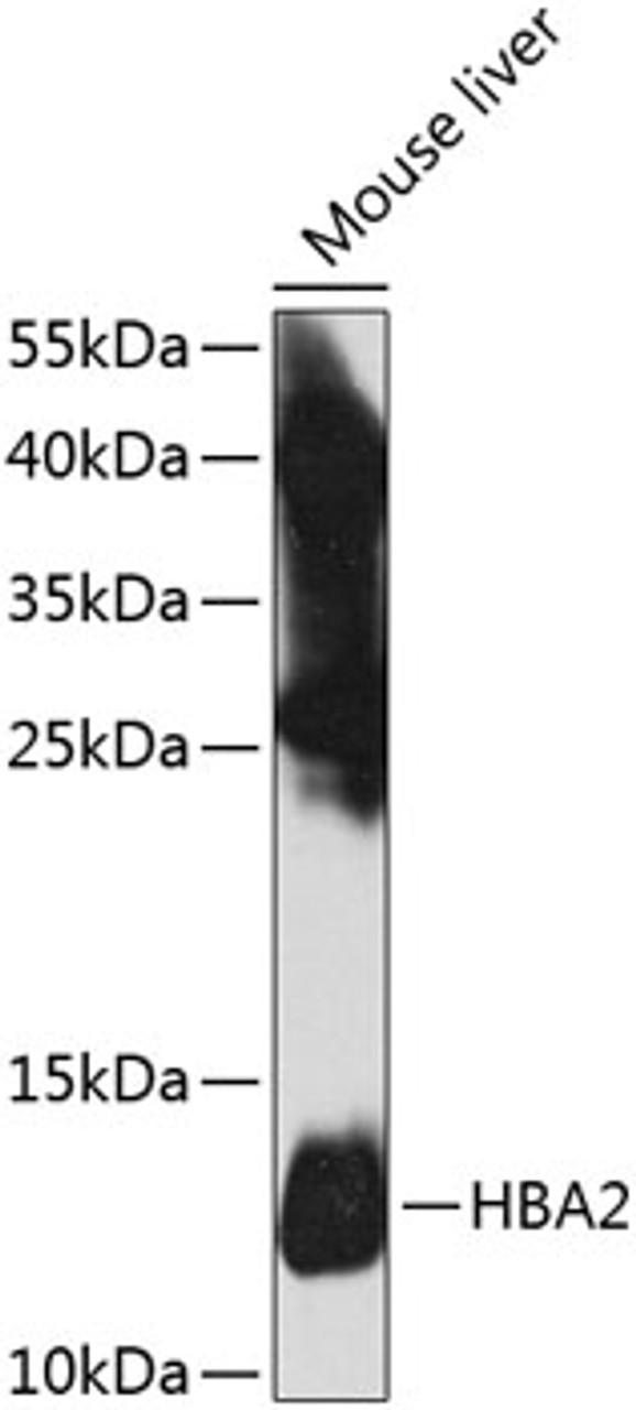 Western blot analysis of extracts of mouse liver, using HBA2 antibody (23-575) at 1:1000 dilution.<br/>Secondary antibody: HRP Goat Anti-Rabbit IgG (H+L) at 1:10000 dilution.<br/>Lysates/proteins: 25ug per lane.<br/>Blocking buffer: 3% nonfat dry milk in TBST.<br/>Detection: ECL Basic Kit.<br/>Exposure time: 10s.