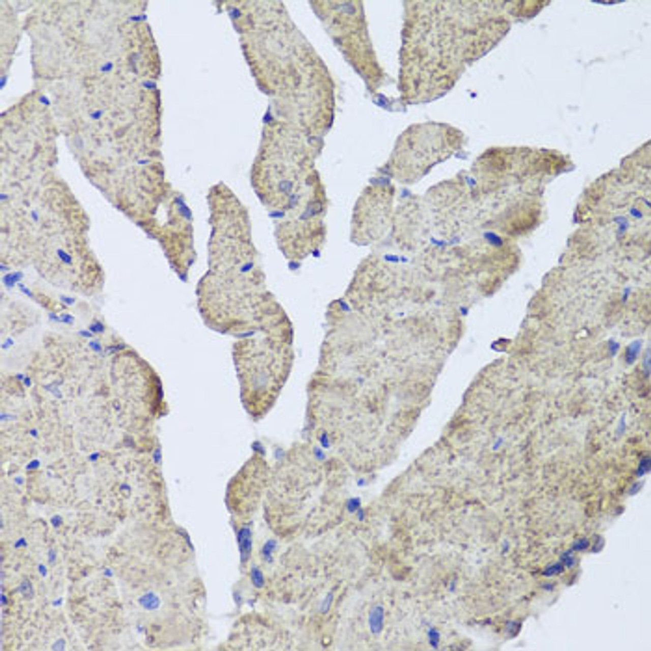Immunohistochemistry of paraffin-embedded mouse heart using HBA2 antibody (23-575) at dilution of 1:100 (40x lens) .