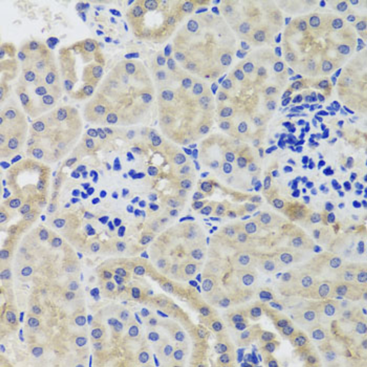 Immunohistochemistry of paraffin-embedded mouse kidney using HK3 antibody (23-576) at dilution of 1:100 (40x lens) .