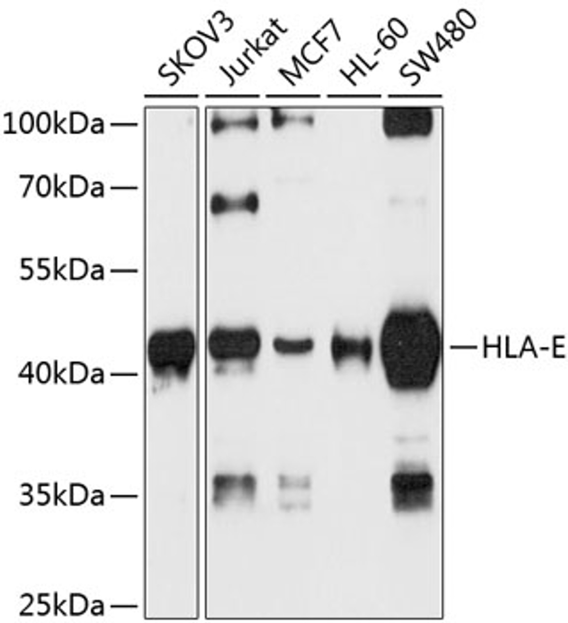 Western blot analysis of extracts of various cell lines, using HLA-E antibody (23-577) at 1:1000 dilution.<br/>Secondary antibody: HRP Goat Anti-Rabbit IgG (H+L) at 1:10000 dilution.<br/>Lysates/proteins: 25ug per lane.<br/>Blocking buffer: 3% nonfat dry milk in TBST.<br/>Detection: ECL Basic Kit.<br/>Exposure time: 90s.