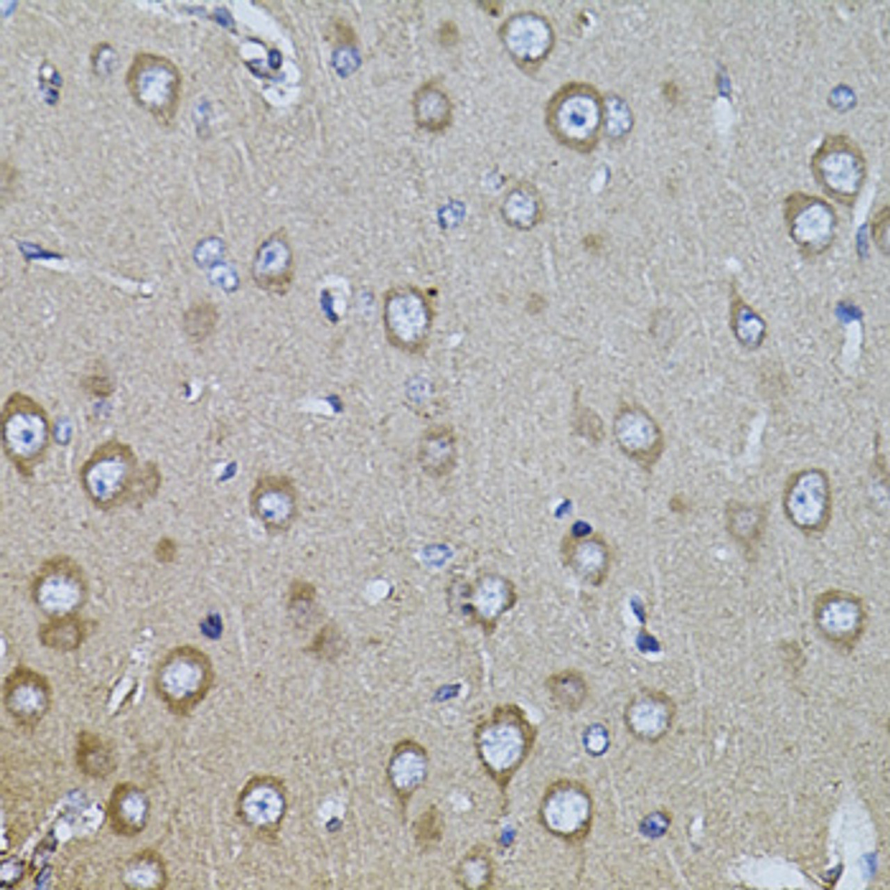 Immunohistochemistry of paraffin-embedded rat brain using ITGB8 antibody (23-580) at dilution of 1:100 (40x lens) .