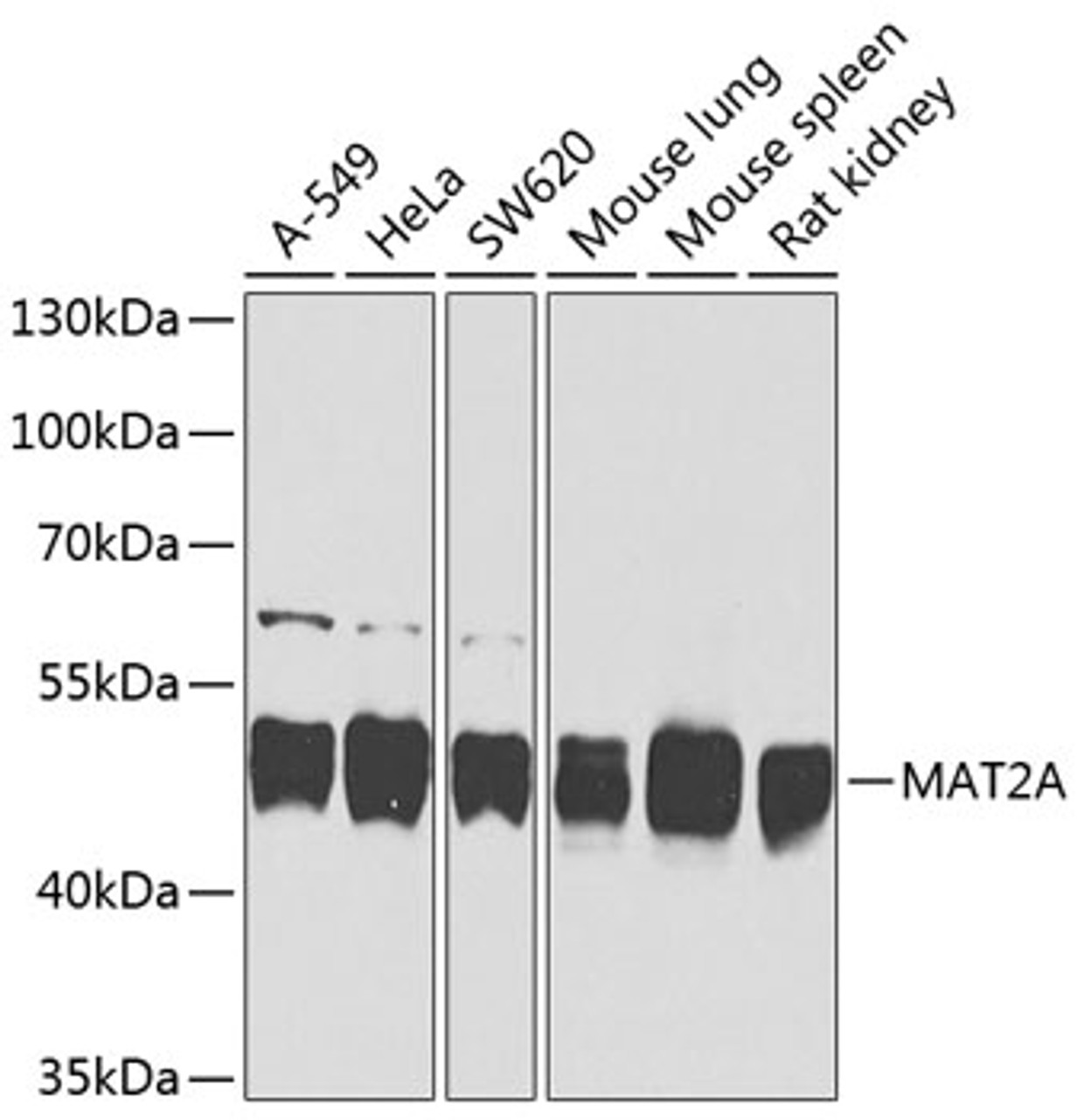 Western blot analysis of extracts of various cell lines, using MAT2A antibody (23-582) at 1:1000 dilution.<br/>Secondary antibody: HRP Goat Anti-Rabbit IgG (H+L) at 1:10000 dilution.<br/>Lysates/proteins: 25ug per lane.<br/>Blocking buffer: 3% nonfat dry milk in TBST.<br/>Detection: ECL Basic Kit.<br/>Exposure time: 15s.