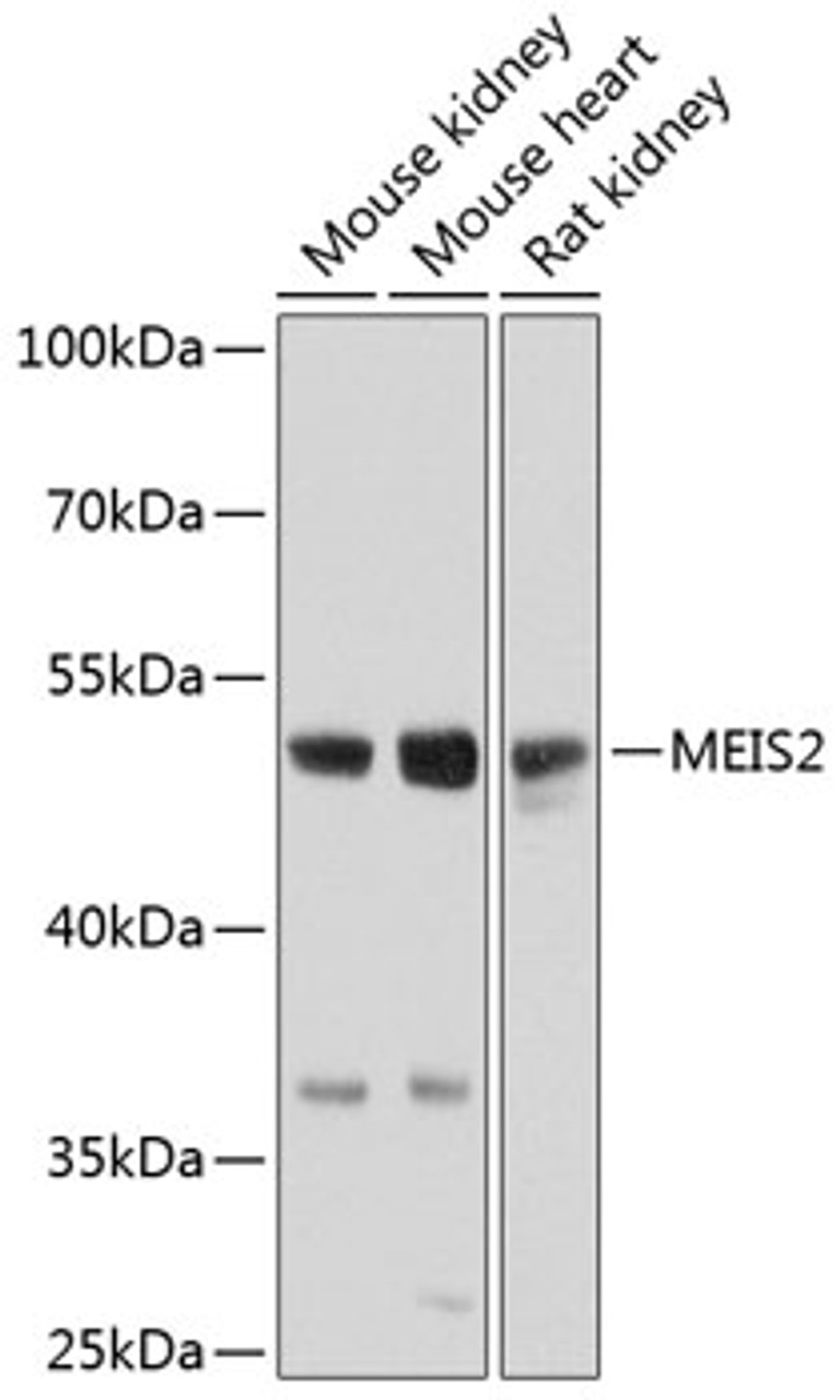 Western blot analysis of extracts of various cell lines, using MEIS2 antibody (23-583) at 1:1000 dilution.<br/>Secondary antibody: HRP Goat Anti-Rabbit IgG (H+L) at 1:10000 dilution.<br/>Lysates/proteins: 25ug per lane.<br/>Blocking buffer: 3% nonfat dry milk in TBST.<br/>Detection: ECL Basic Kit.<br/>Exposure time: 10s.