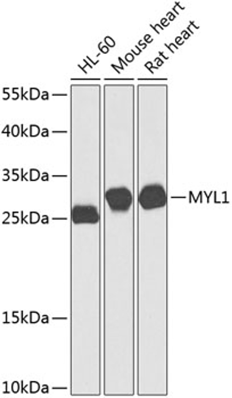 Western blot analysis of extracts of various cell lines, using MYL1 antibody (23-584) at 1:1000 dilution.<br/>Secondary antibody: HRP Goat Anti-Rabbit IgG (H+L) at 1:10000 dilution.<br/>Lysates/proteins: 25ug per lane.<br/>Blocking buffer: 3% nonfat dry milk in TBST.<br/>Detection: ECL Basic Kit.<br/>Exposure time: 60s.