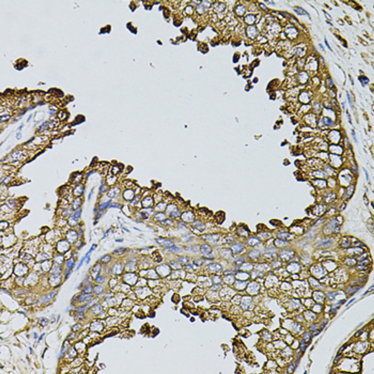 Immunohistochemistry of paraffin-embedded human prostate using MYL1 antibody (23-584) at dilution of 1:100 (40x lens) .