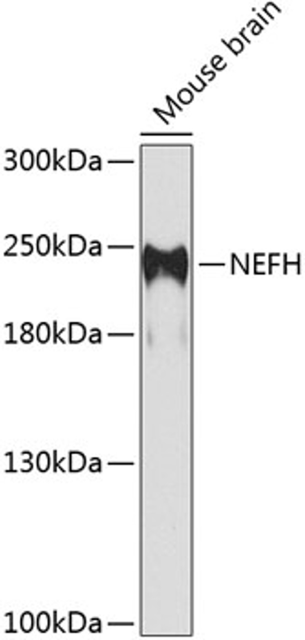 Western blot analysis of extracts of mouse brain, using NEFH antibody (23-587) at 1:1000 dilution._Secondary antibody: HRP Goat Anti-Rabbit IgG (H+L) at 1:10000 dilution._Lysates/proteins: 25ug per lane._Blocking buffer: 3% nonfat dry milk in TBST._Detection: ECL Enhanced Kit._Exposure time: 60s.