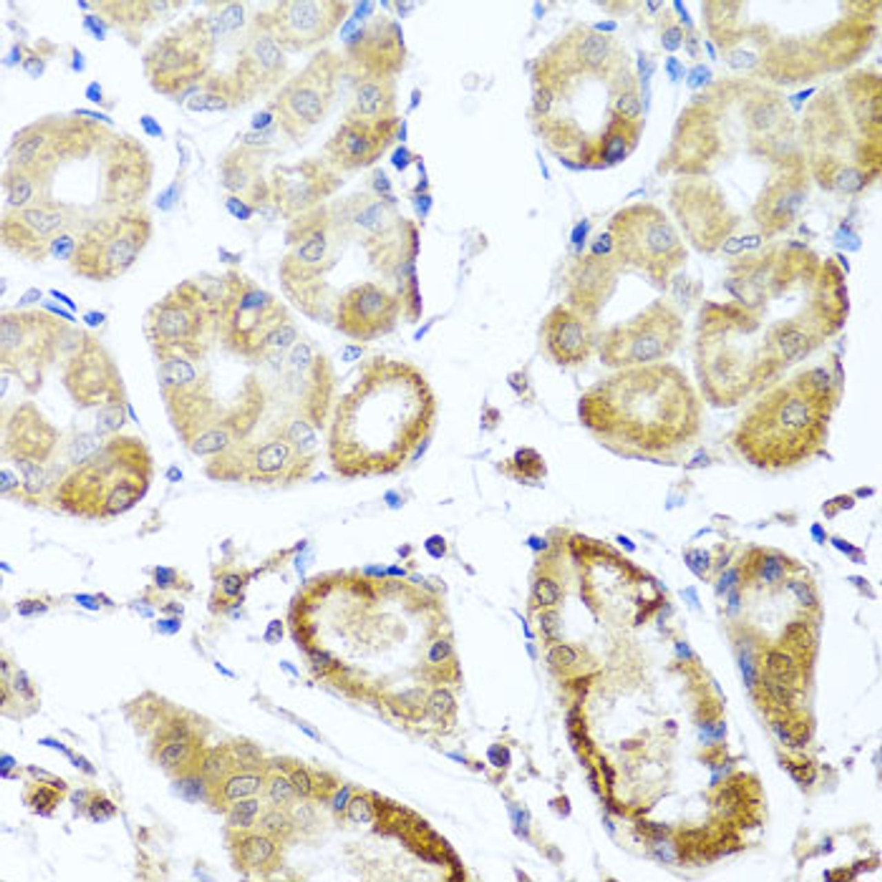 Immunohistochemistry of paraffin-embedded human stomach using PER1 antibody (23-592) at dilution of 1:100 (40x lens) .
