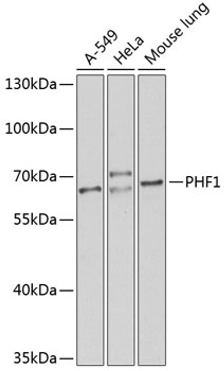 Western blot analysis of extracts of various cell lines, using PHF1 antibody (23-593) at 1:1000 dilution.<br/>Secondary antibody: HRP Goat Anti-Rabbit IgG (H+L) at 1:10000 dilution.<br/>Lysates/proteins: 25ug per lane.<br/>Blocking buffer: 3% nonfat dry milk in TBST.<br/>Detection: ECL Basic Kit.<br/>Exposure time: 90s.