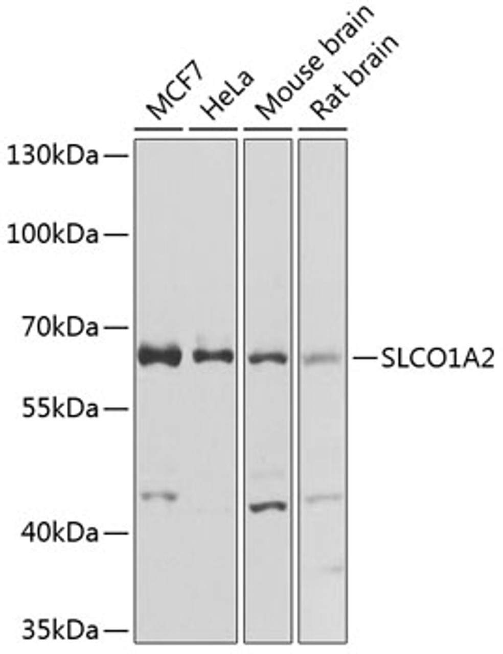 Western blot analysis of extracts of various cell lines, using SLCO1A2 antibody (23-594) at 1:1000 dilution.<br/>Secondary antibody: HRP Goat Anti-Rabbit IgG (H+L) at 1:10000 dilution.<br/>Lysates/proteins: 25ug per lane.<br/>Blocking buffer: 3% nonfat dry milk in TBST.<br/>Detection: ECL Basic Kit.<br/>Exposure time: 10s.