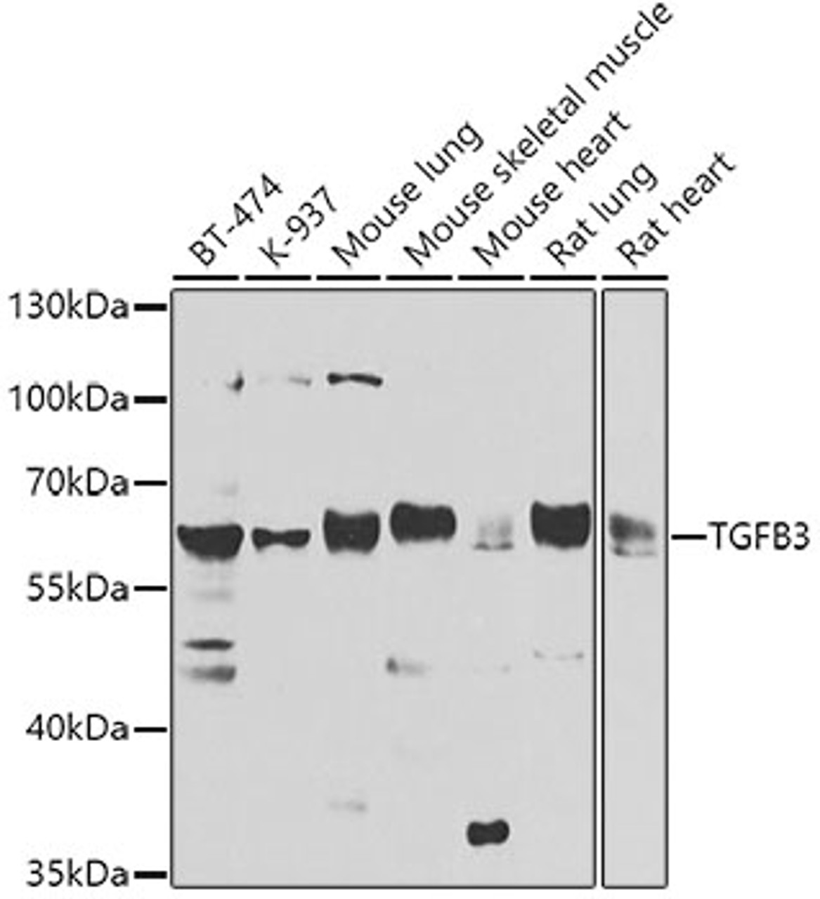 Western blot analysis of extracts of various cell lines, using TGFB3 antibody (23-598) at 1:1000 dilution.<br/>Secondary antibody: HRP Goat Anti-Rabbit IgG (H+L) at 1:10000 dilution.<br/>Lysates/proteins: 25ug per lane.<br/>Blocking buffer: 3% nonfat dry milk in TBST.<br/>Detection: ECL Basic Kit.<br/>Exposure time: 90s.