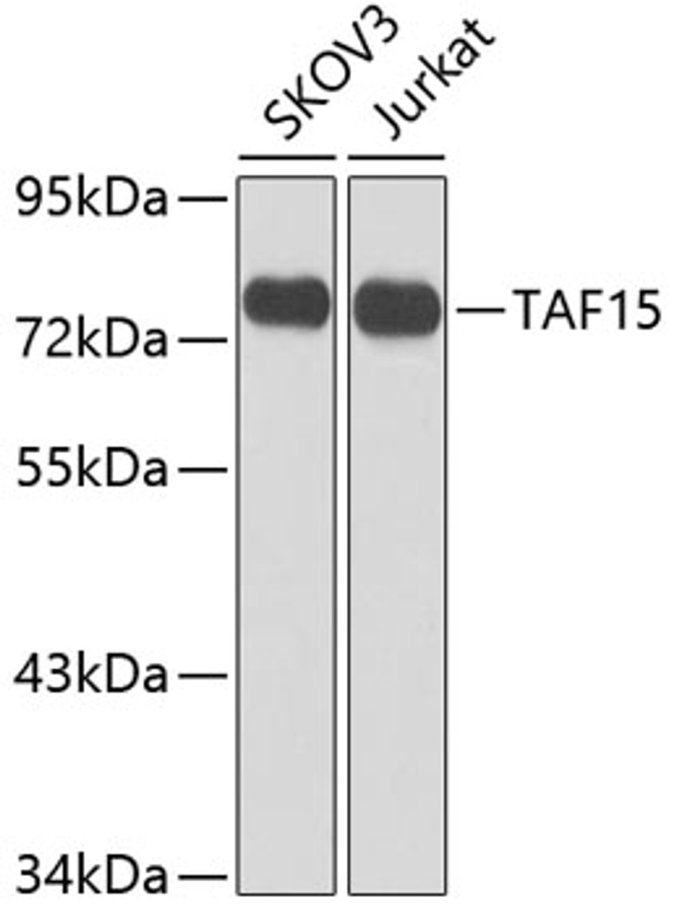 Western blot analysis of extracts of various cell lines, using TAF15 antibody (23-602) at 1:1000 dilution.<br/>Secondary antibody: HRP Goat Anti-Rabbit IgG (H+L) at 1:10000 dilution.<br/>Lysates/proteins: 25ug per lane.<br/>Blocking buffer: 3% nonfat dry milk in TBST.<br/>Detection: ECL Enhanced Kit.<br/>Exposure time: 5s.