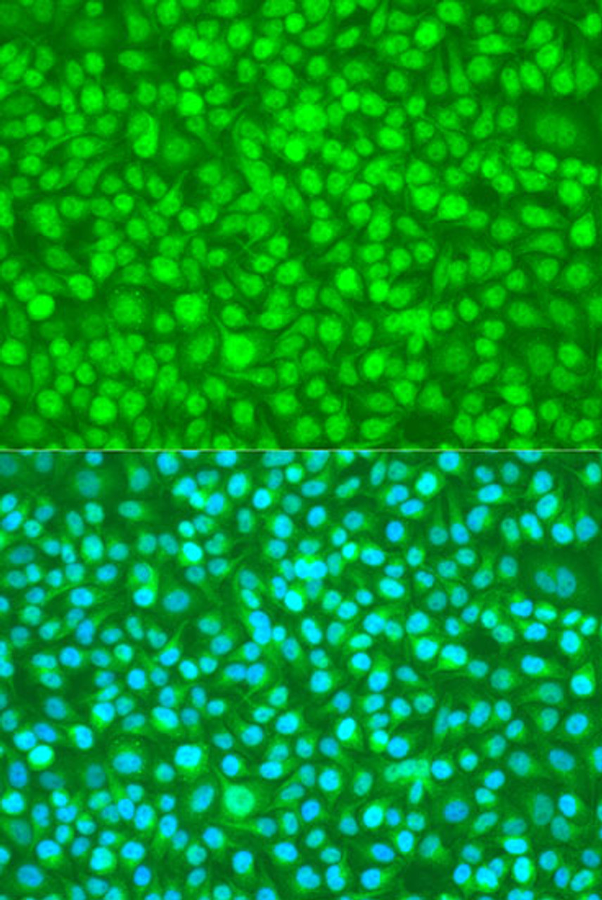 Immunofluorescence analysis of U2OS cells using N4BP1 antibody (23-608) at dilution of 1:100. Blue: DAPI for nuclear staining.