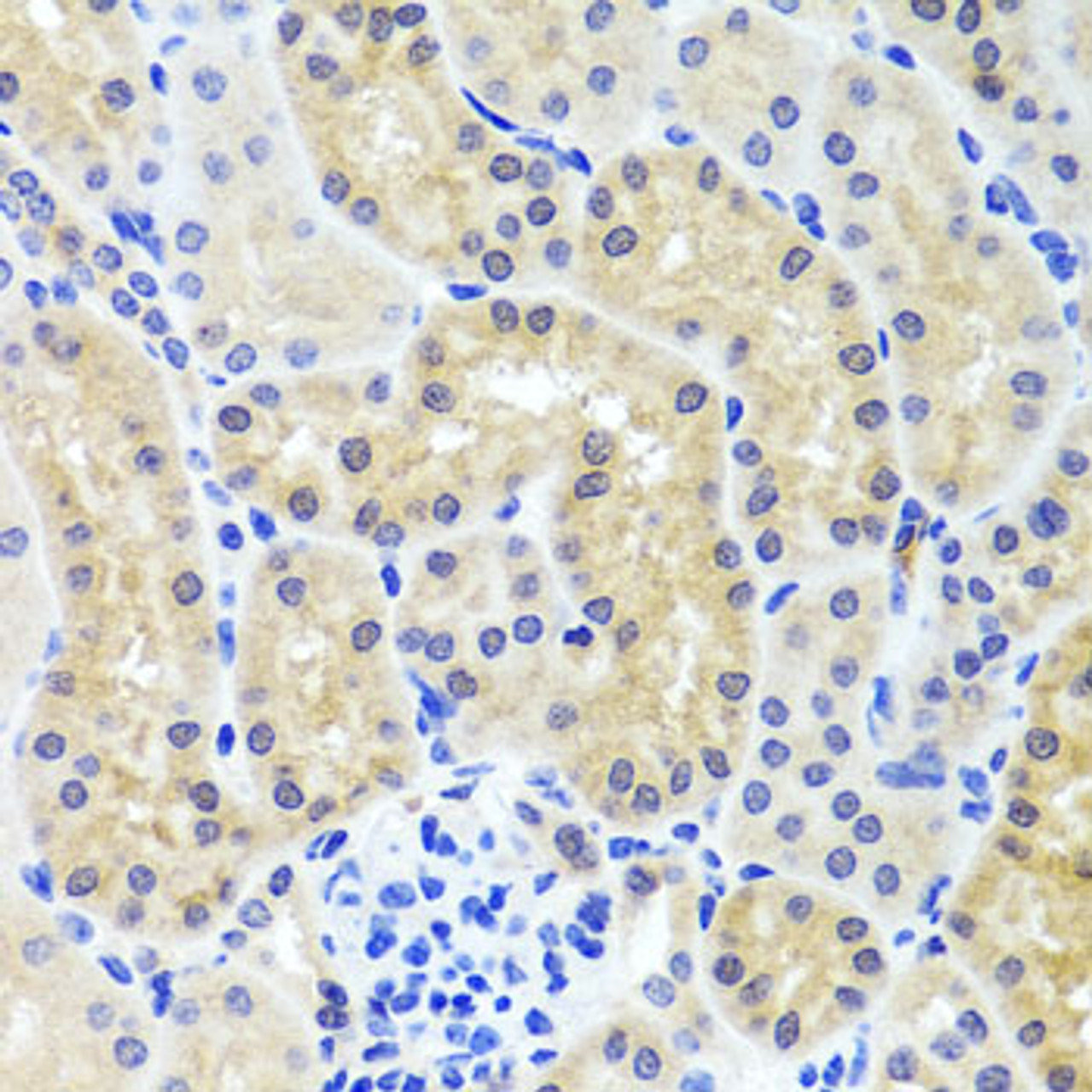 Immunohistochemistry of paraffin-embedded mouse kidney using INADL antibody (23-610) at dilution of 1:100 (40x lens) .