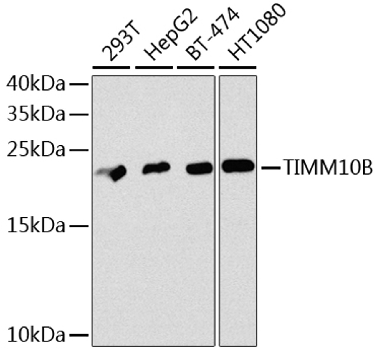 Western blot analysis of extracts of various cell lines, using TIMM10B antibody (23-618) at 1:1000 dilution.<br/>Secondary antibody: HRP Goat Anti-Rabbit IgG (H+L) at 1:10000 dilution.<br/>Lysates/proteins: 25ug per lane.<br/>Blocking buffer: 3% nonfat dry milk in TBST.<br/>Detection: ECL Basic Kit.<br/>Exposure time: 90s.