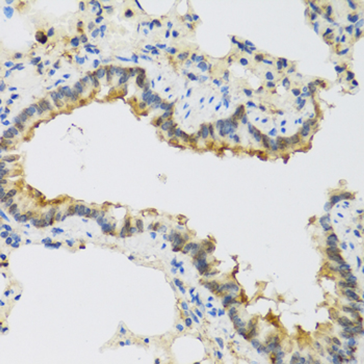 Immunohistochemistry of paraffin-embedded rat lung using FAM20A antibody (23-624) at dilution of 1:100 (40x lens) .