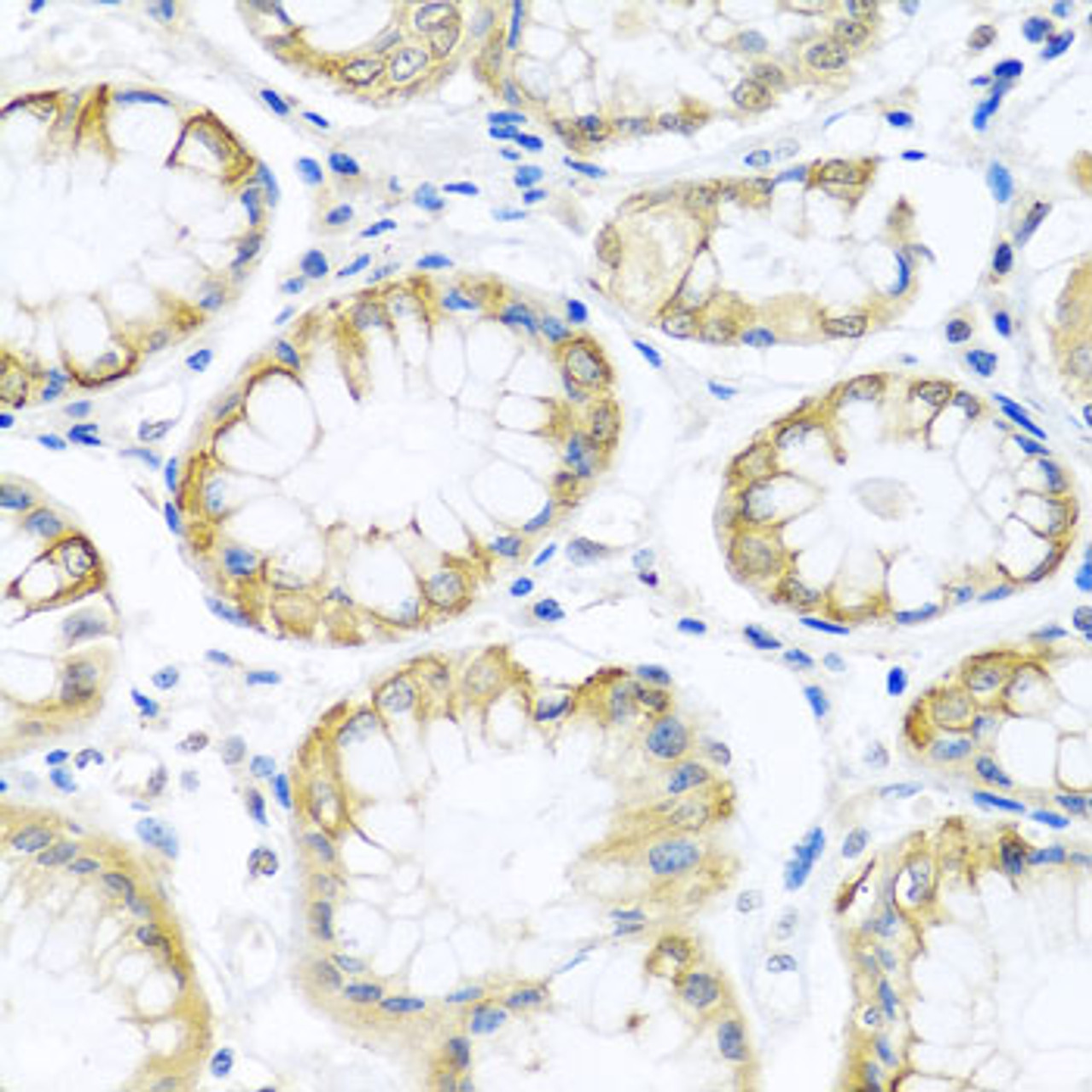 Immunohistochemistry of paraffin-embedded human stomach using PCDHA12 antibody (23-627) at dilution of 1:100 (40x lens) .