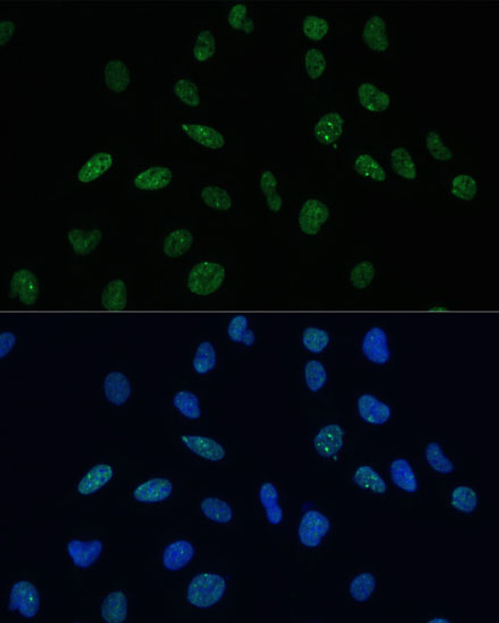Immunofluorescence analysis of U-2 OS cells using MKL1 Polyclonal Antibody (23-628) at dilution of 1:100 (40x lens) . Blue: DAPI for nuclear staining.