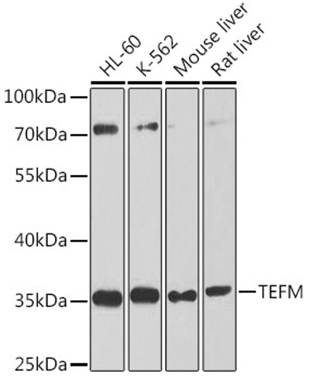 Western blot analysis of extracts of various cell lines, using TEFM antibody (23-631) at 1:1000 dilution.<br/>Secondary antibody: HRP Goat Anti-Rabbit IgG (H+L) at 1:10000 dilution.<br/>Lysates/proteins: 25ug per lane.<br/>Blocking buffer: 3% nonfat dry milk in TBST.<br/>Detection: ECL Basic Kit.<br/>Exposure time: 90s.