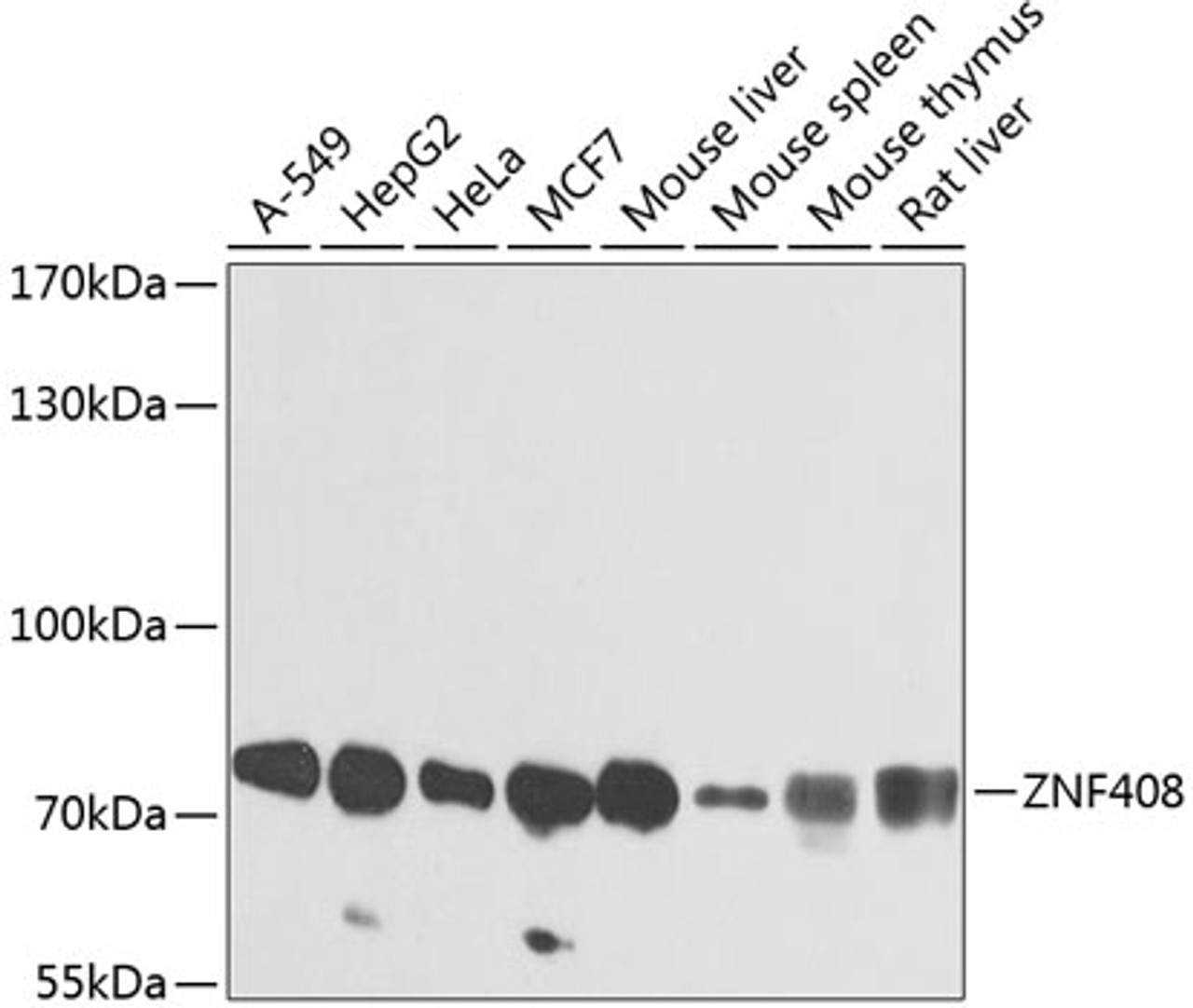 Western blot analysis of extracts of various cell lines, using ZNF408 antibody (23-632) at 1:1000 dilution.<br/>Secondary antibody: HRP Goat Anti-Rabbit IgG (H+L) at 1:10000 dilution.<br/>Lysates/proteins: 25ug per lane.<br/>Blocking buffer: 3% nonfat dry milk in TBST.<br/>Detection: ECL Enhanced Kit.<br/>Exposure time: 1s.