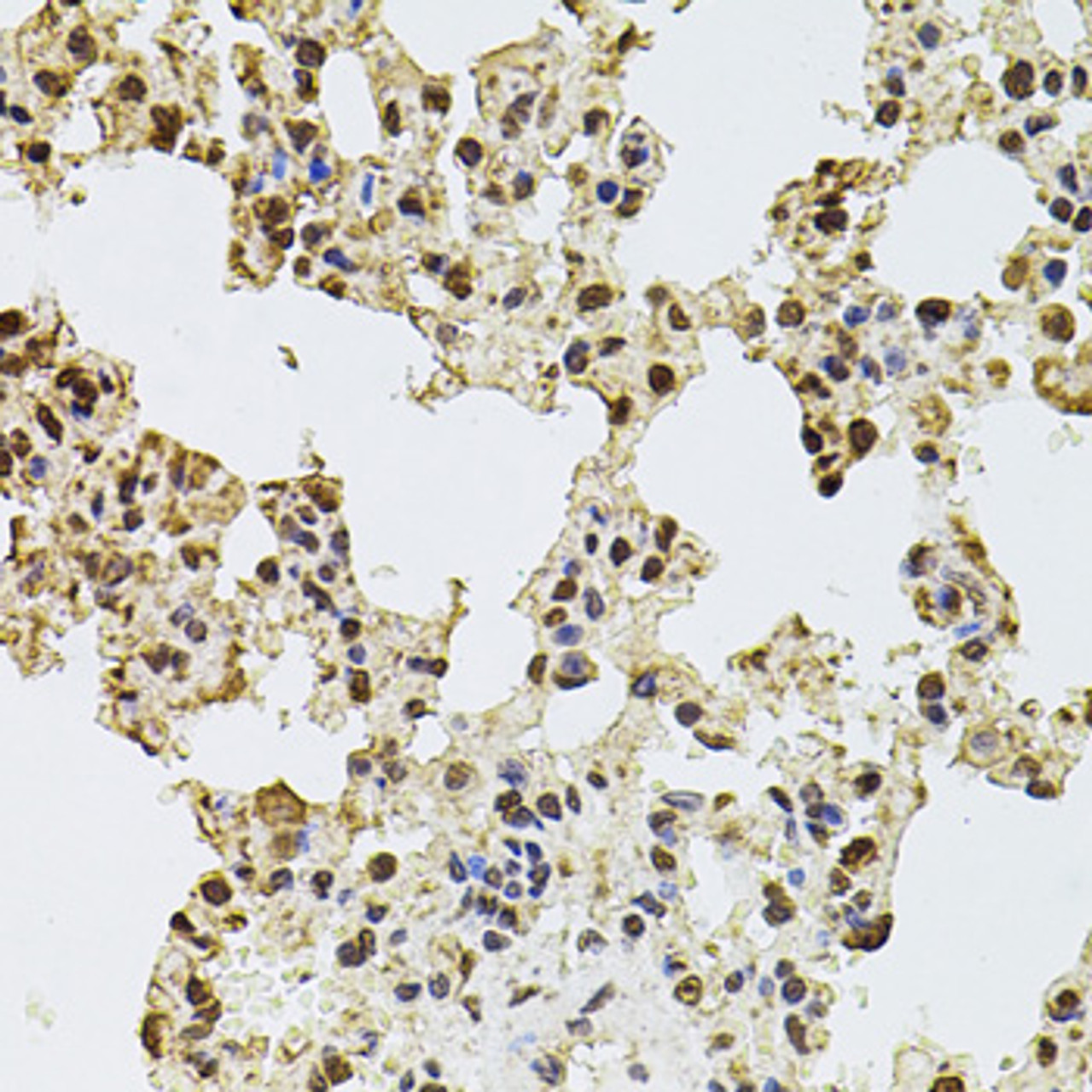 Immunohistochemistry of paraffin-embedded rat lung using ZNF408 antibody (23-632) at dilution of 1:100 (40x lens) .