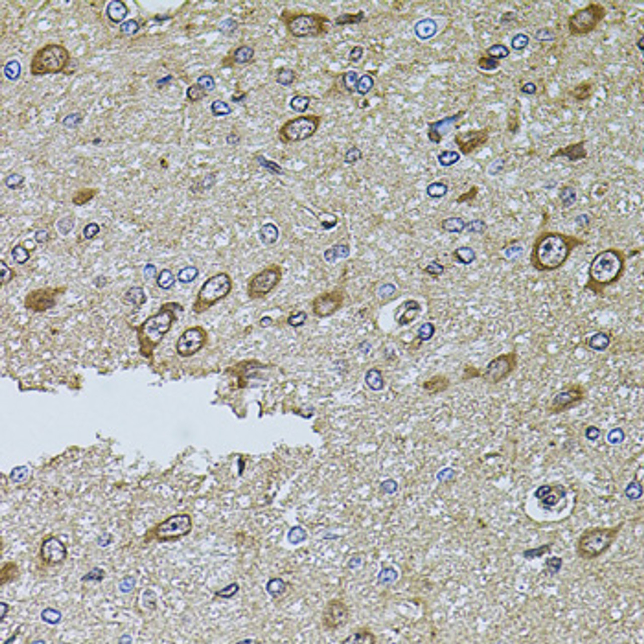 Immunohistochemistry of paraffin-embedded rat brain using MTIF3 antibody (23-638) at dilution of 1:100 (40x lens) .