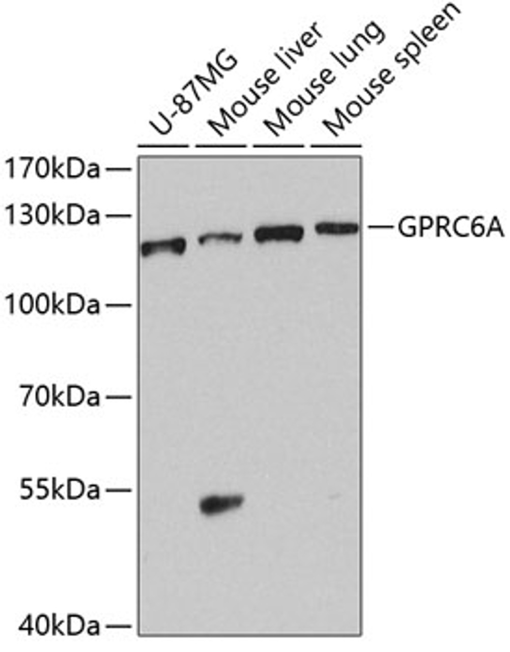 Western blot analysis of extracts of various cell lines, using GPRC6A antibody (23-639) at 1:1000 dilution.<br/>Secondary antibody: HRP Goat Anti-Rabbit IgG (H+L) at 1:10000 dilution.<br/>Lysates/proteins: 25ug per lane.<br/>Blocking buffer: 3% nonfat dry milk in TBST.<br/>Detection: ECL Basic Kit.<br/>Exposure time: 90s.