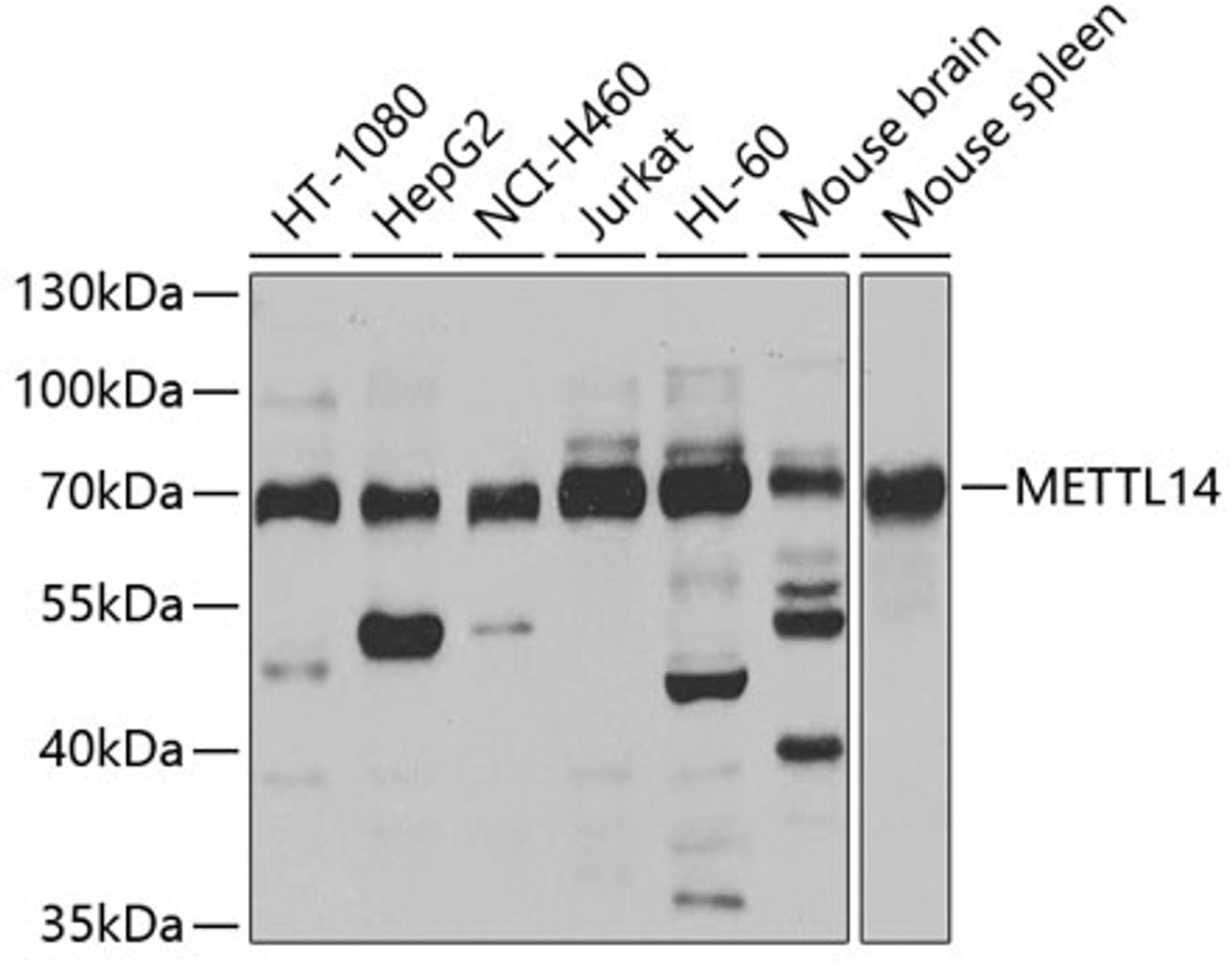 Western blot analysis of extracts of various cell lines, using METTL14 antibody (23-641) at 1:1000 dilution.<br/>Secondary antibody: HRP Goat Anti-Rabbit IgG (H+L) at 1:10000 dilution.<br/>Lysates/proteins: 25ug per lane.<br/>Blocking buffer: 3% nonfat dry milk in TBST.<br/>Detection: ECL Basic Kit.<br/>Exposure time: 10s.