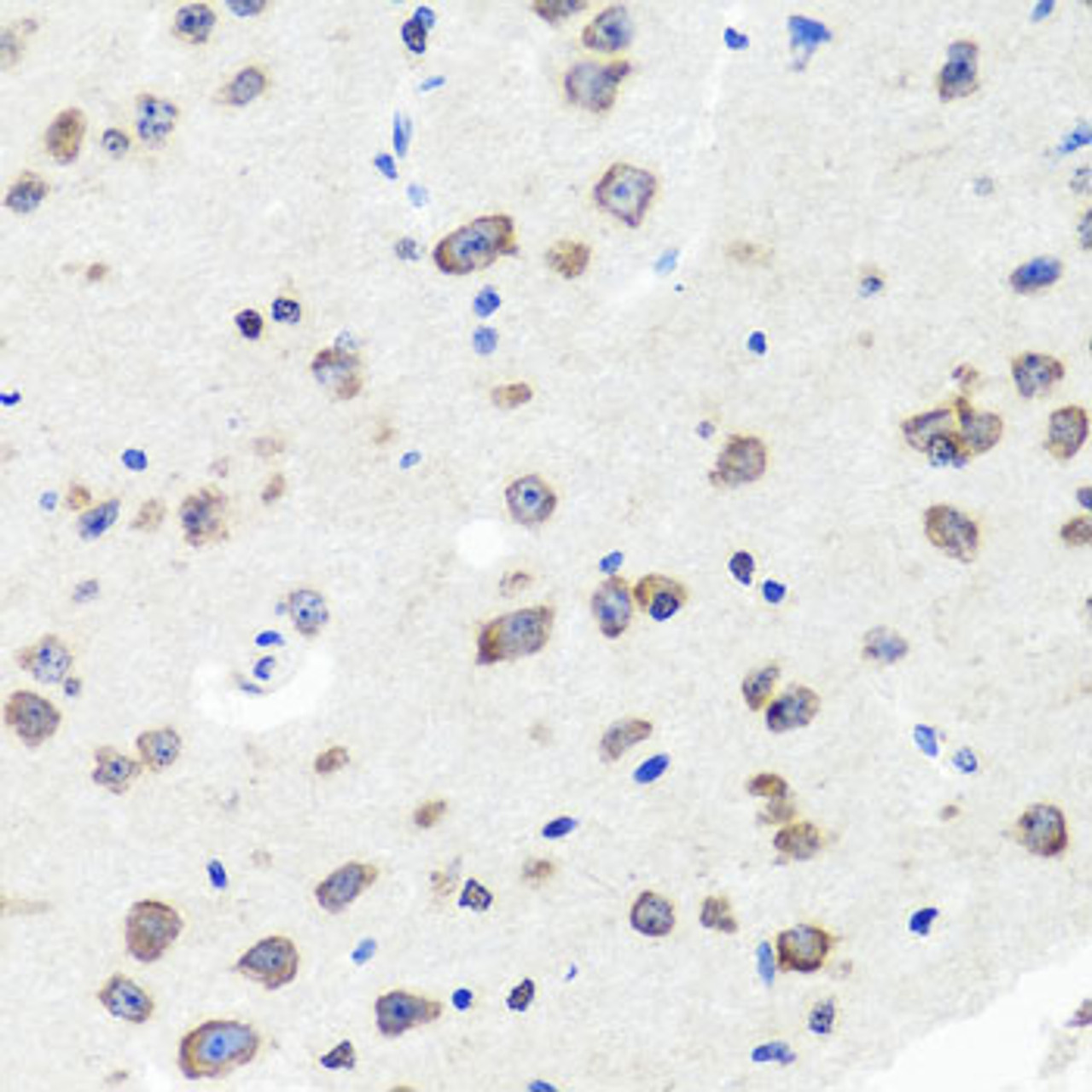 Immunohistochemistry of paraffin-embedded mouse brain using DLG1 antibody (23-649) at dilution of 1:100 (40x lens) .