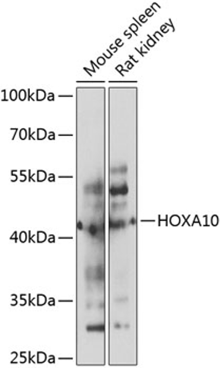 Western blot analysis of extracts of various cell lines, using HOXA10 antibody (23-652) at 1:1000 dilution._Secondary antibody: HRP Goat Anti-Rabbit IgG (H+L) at 1:10000 dilution._Lysates/proteins: 25ug per lane._Blocking buffer: 3% nonfat dry milk in TBST._Detection: ECL Enhanced Kit._Exposure time: 10s.