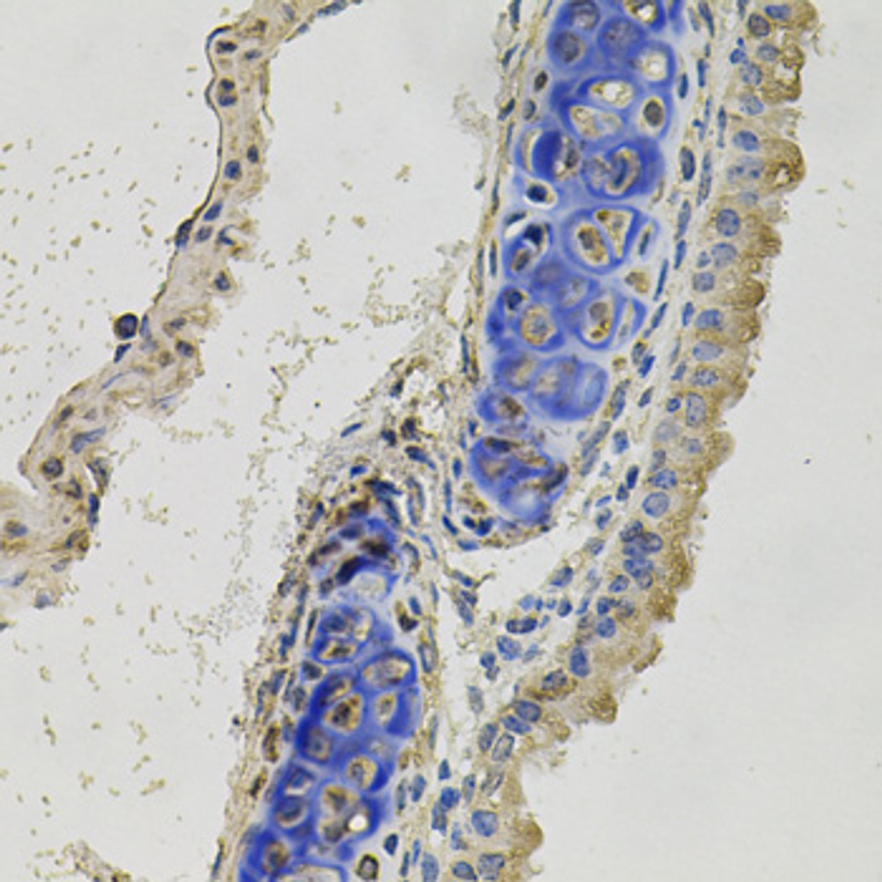Immunohistochemistry of paraffin-embedded mouse lung using INHBB antibody (23-654) at dilution of 1:100 (40x lens) .