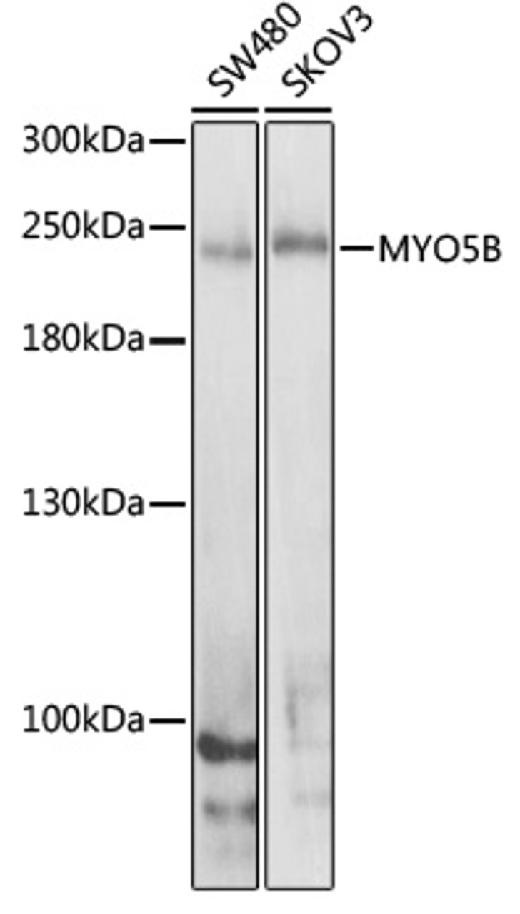 Western blot analysis of extracts of various cell lines, using MYO5B antibody (23-658) at 1:1000 dilution.<br/>Secondary antibody: HRP Goat Anti-Rabbit IgG (H+L) at 1:10000 dilution.<br/>Lysates/proteins: 25ug per lane.<br/>Blocking buffer: 3% nonfat dry milk in TBST.<br/>Detection: ECL Enhanced Kit.<br/>Exposure time: 30s.