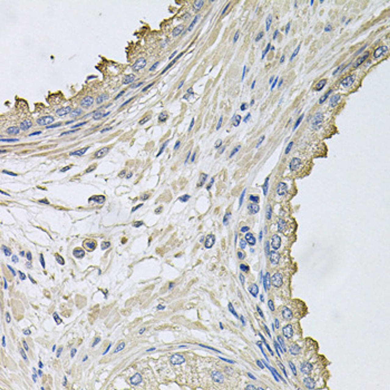 Immunohistochemistry of paraffin-embedded human prostate using HERC3 antibody (23-661) at dilution of 1:100 (40x lens) .