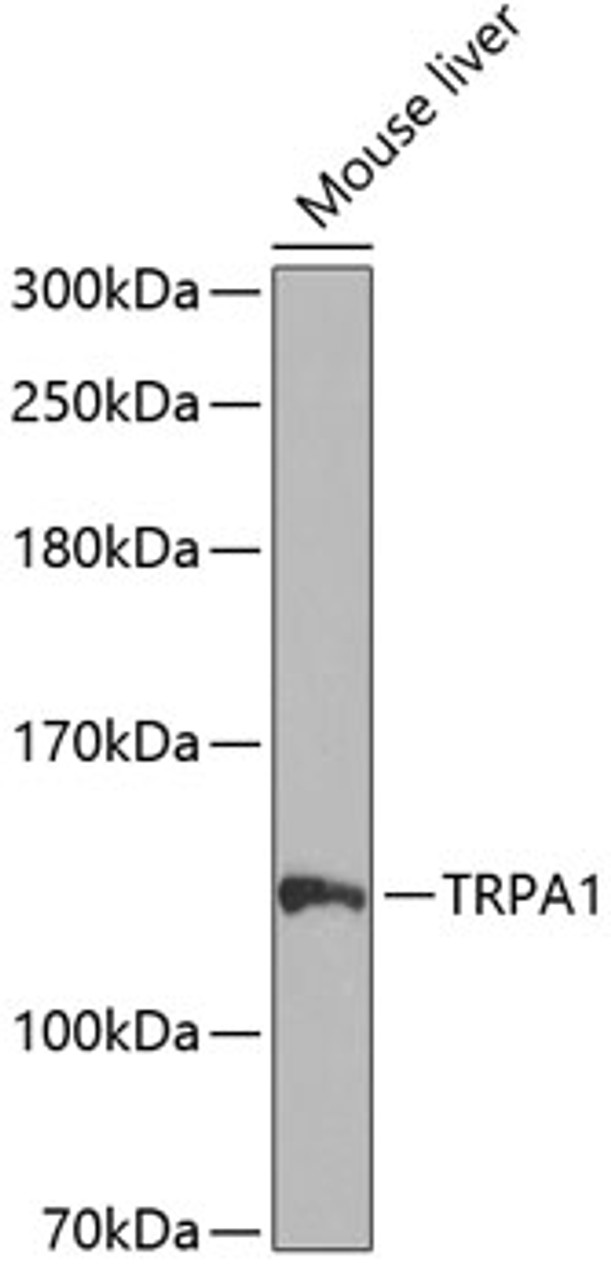 Western blot analysis of extracts of mouse liver, using TRPA1 antibody (23-662) at 1:1000 dilution.<br/>Secondary antibody: HRP Goat Anti-Rabbit IgG (H+L) at 1:10000 dilution.<br/>Lysates/proteins: 25ug per lane.<br/>Blocking buffer: 3% nonfat dry milk in TBST.<br/>Detection: ECL Enhanced Kit.<br/>Exposure time: 90s.