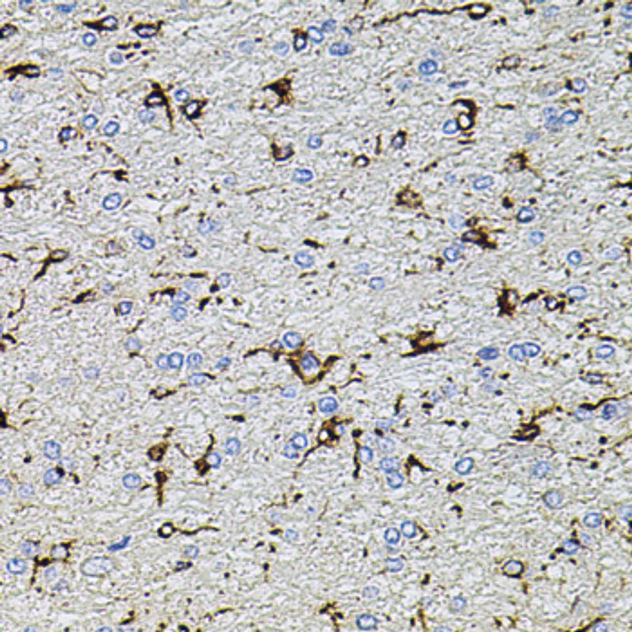 Immunohistochemistry of paraffin-embedded rat brain using TRPA1 antibody (23-662) at dilution of 1:100 (40x lens) .